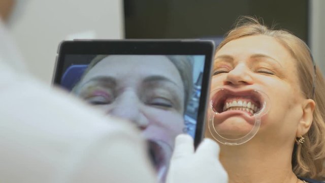 The doctor in a special computer program loaded into the tablet checks and regulates the bite. Gives a photo with a tablet. The program automatically checks the data and shows overbite. The dentist is