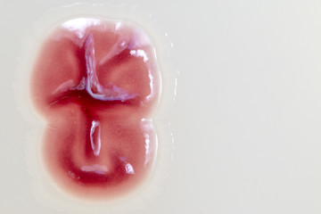 Serratia marcescens is a species of rod-shaped gram-negative bacteria in the family Enterobacteriaceae for Laboratory microbiology.