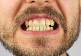 closed human teeth grin, closeup