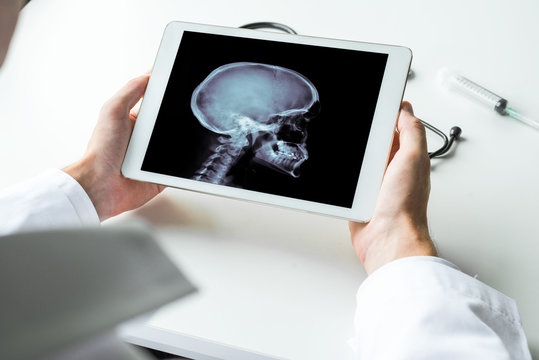 Doctor watching a x-ray of brain on digital tablet. Radiology concept