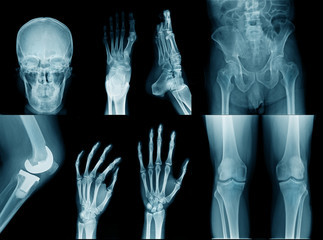 collection xray head, foot, hip, hand and leg