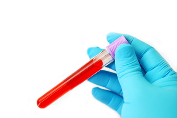 Blood sample tube for laboratory testing, white background