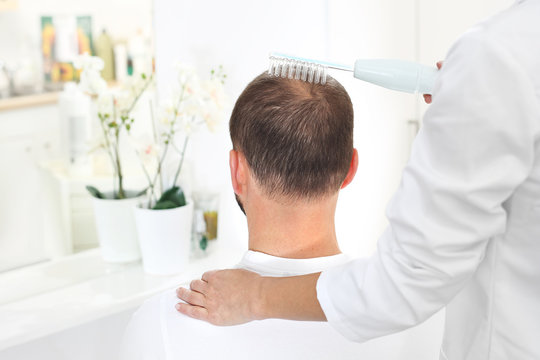 Mezoterapia tlenowa sk&oacute;ry głowy.  Głowa mężczyzny z przerzedzonymi włosami podczas zabiegu pielęgnacyjnego