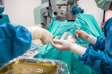 Eye surgeon at work.