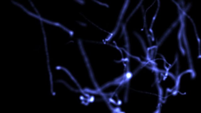 4k Abstract floating microscopic micro nano firework lines particle,Dirt dust bacteria cells spores roundworm parasites virus background.