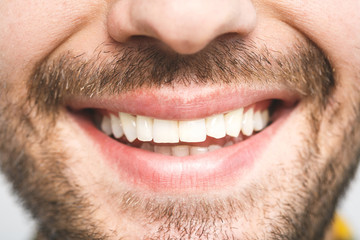 Detailed image of young man smiling with perfect white teeth. Healthy concept. Close-up. - Powered by Adobe