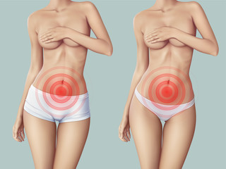 Slim woman suffering from abdominal pain. The slim woman's body and symbol of pain that can by used for indicate some kind of pain in any places on body. realistic vector illustration