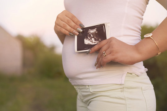 Pregnant woman hold ultrasound print