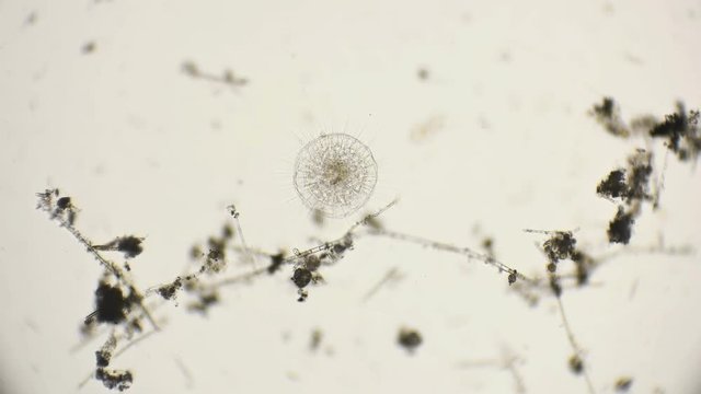 the simplest organisms of the Heliozoa class, similar to radiolarians, under a microscope