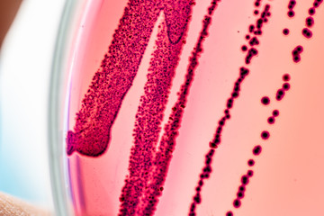 Colony Characteristics of Escherichia coli (E. coli) is a Gram-negative, facultatively anaerobic,...