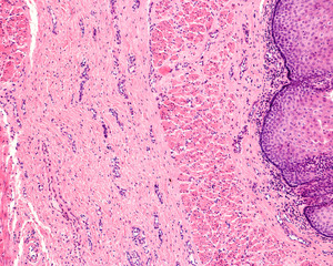 Esophagus. Muscularis mucosae
