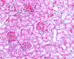 Renal congestion