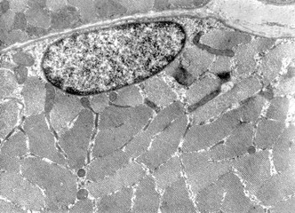 Striated muscle fiber