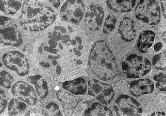Mitosis. TEM