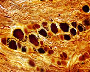 Dorsal root ganglion. Pseudounipolar neurons