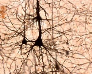 Pyramidal cell. Cerebral cortex