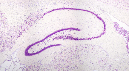 Hippocampus