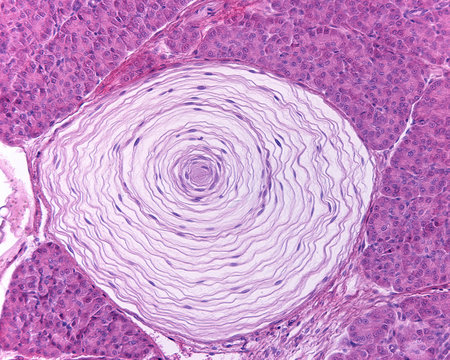Pacinian corpuscle