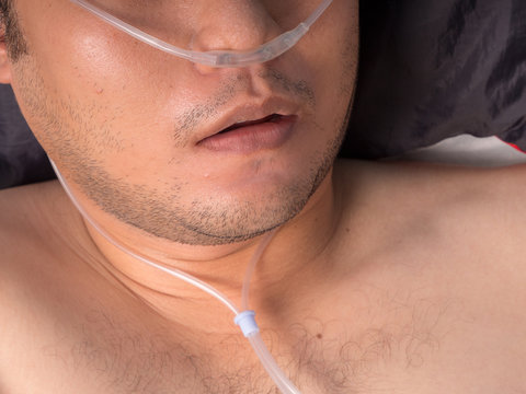 male patient with oxygen tube.