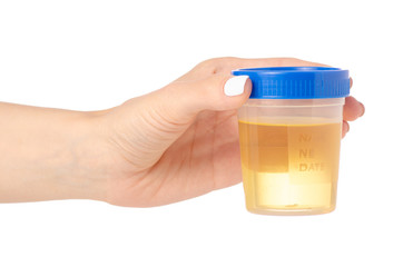 Plastic container with urine in hand analysis on white background isolation