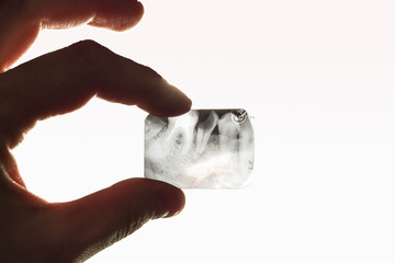 A photograph of a sick tooth is held by a hand opposite the light