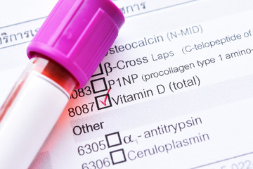 Obraz premium Blood sample with requisition form for vitamin D test