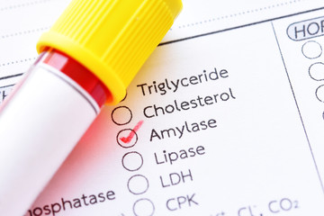 Blood sample with requisition form for amylase enzyme test, diagnosis for pancreatitis