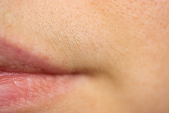 small hairs above lips