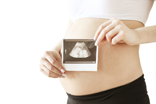Close up of pregnant woman wearing supportive seamless maternity bra & black yoga pants holding fetus ultrasound scan of baby in her tummy, first photo of a child. White wall background.. Copy space.