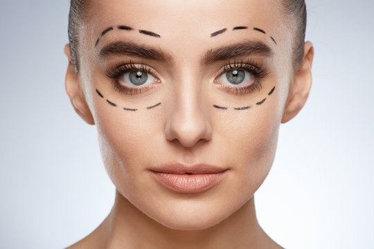 Woman with puncture line under eyes