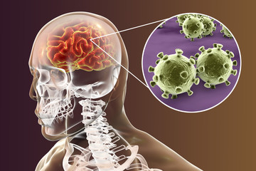 Viral meningitis and encephalitis, medical concept, 3D illustration showing brain infection and close-up view of viruses in the brain - obrazy, fototapety, plakaty