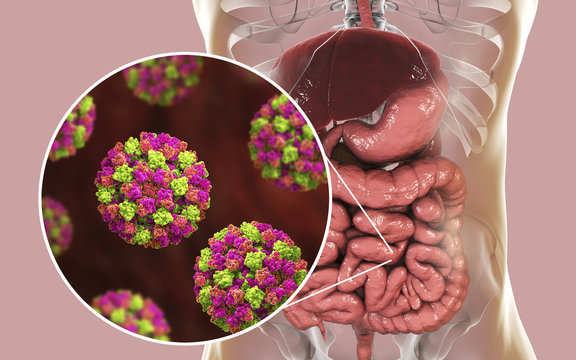 Norovirus in human intestine, also called winter vomiting bug, RNA virus from Caliciviridae family, causative agent of gastroenteritis with diarrhea, vomiting, stomach pain. 3D illustration