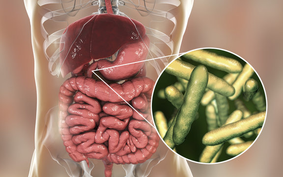 Tropheryma whipplei bacteria in human duodenum, the causative organism of Whipple's disease, 3D illustration