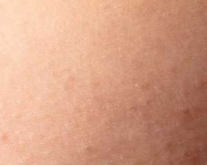 A white man's skin as a background