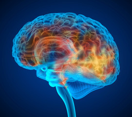 Human brain tumor X-ray scan , Medically accurate 3D illustration - obrazy, fototapety, plakaty