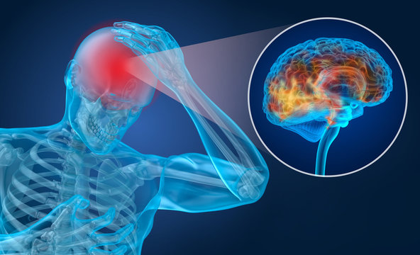 Concussion Images – Browse 10,201 Stock Photos, Vectors, and Video | Adobe Stock