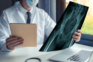 Doctor watching a x-ray of bones of hips and holding a digital tablet