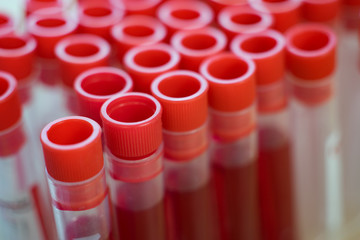 blood tube test for hand of a lab technician or medical doctor holding and background a rack of color tubes  and microscope with blood samples other patients in laboratory