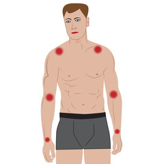 Joint pain in arms  from infected or injury male body