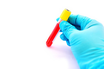 Blood sample tube for laboratory testing, white background
