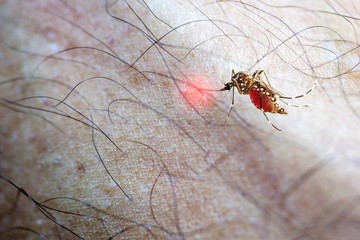 Close-up of  Aedes aegypti Mosquito sucking human blood ,  mosquito that can spread dengue fever, chikungunya, Zika fever, Mayaro and yellow fever viruses, and other disease agents.