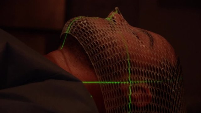 Close up of patient's face getting cancer radiation therapy from a linear accelerator machine in hospital