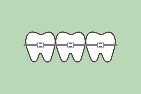 orthodontic teeth or dental braces