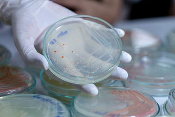 Serratia marcescens is a species of rod-shaped gram-negative bacteria in the family Enterobacteriaceae for Laboratory microbiology.