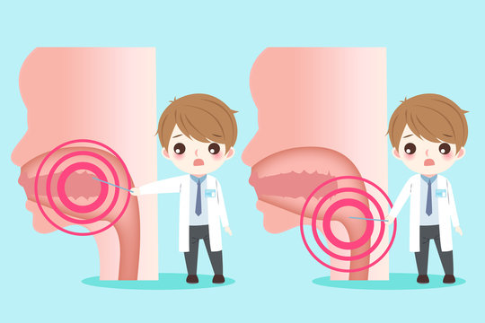 doctor with oral cancer concept