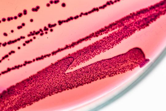 Colony Characteristics of Escherichia coli (E. coli) is a Gram-negative, facultatively anaerobic, rod-shaped, coliform bacterium of the genus Escherichia that is commonly found in the lower intestine.