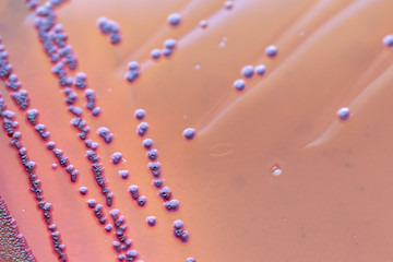Colony Characteristics of Escherichia coli (E. coli) is a Gram-negative, facultatively anaerobic, rod-shaped, coliform bacterium of the genus Escherichia that is commonly found in the lower intestine.