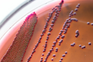 Colony Characteristics of Escherichia coli (E. coli) is a Gram-negative, facultatively anaerobic,...