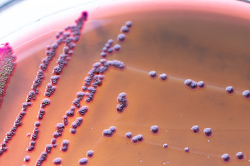 Colony Characteristics of Escherichia coli (E. coli) is a Gram-negative, facultatively anaerobic,...