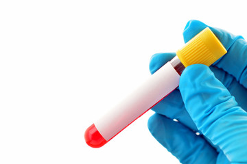 Yellow cap tube with blood sample for laboratory testing, white background